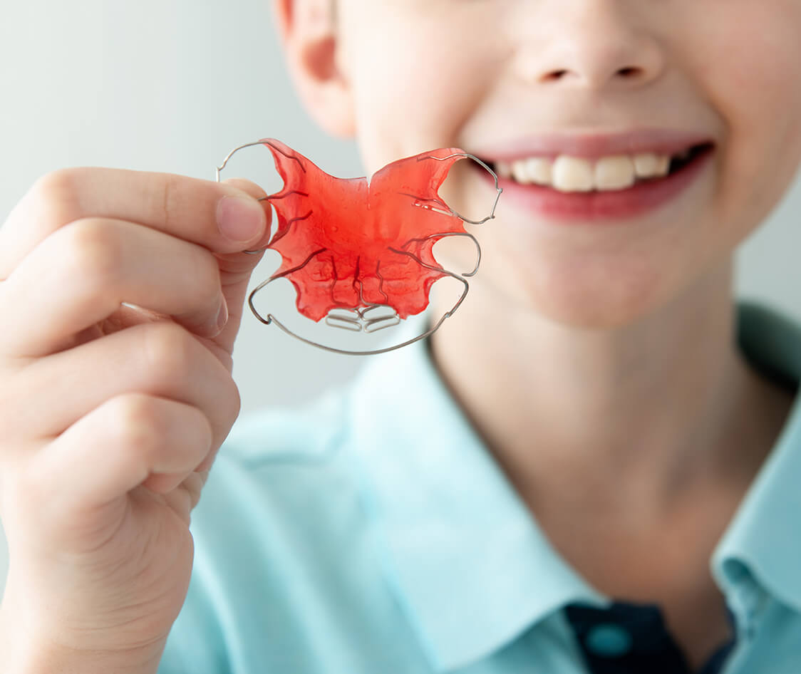 Child Holding Red Orthodontic Braces Retainer