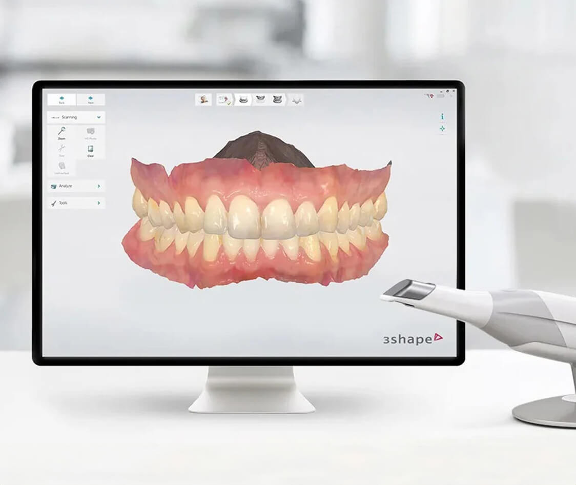 3shape scanner